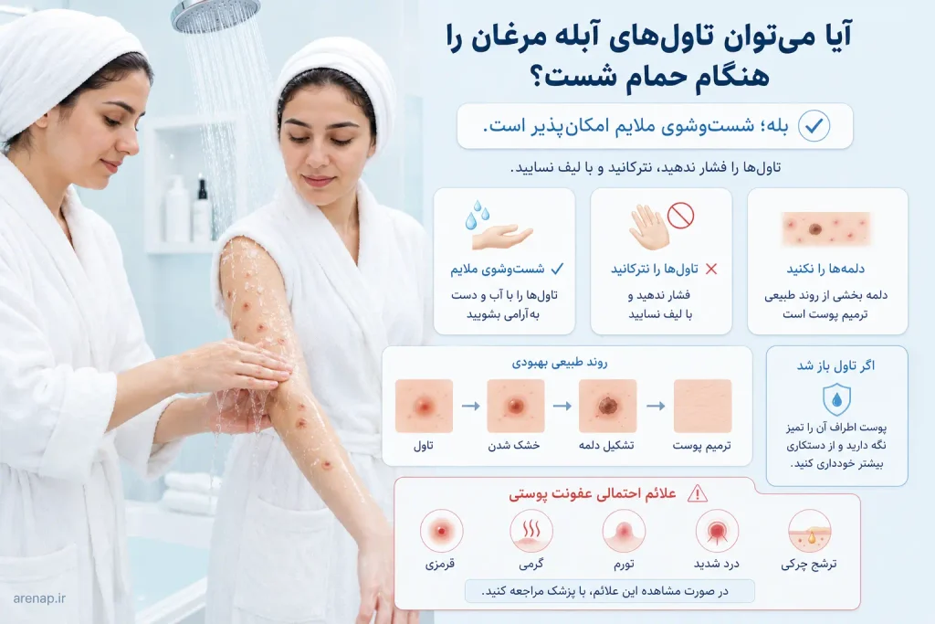 آموزش شست‌وشوی ملایم تاول‌ها و ضایعات آبله مرغان هنگام حمام بدون ترکاندن یا دستکاری دلمه‌ها