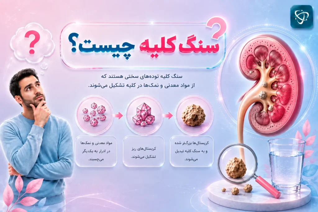 سنگ کلیه چیست؟-آرناپ
