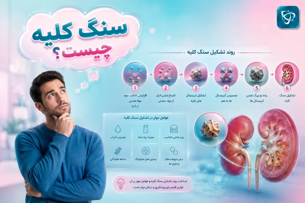 فرآیند تشکیل سنگ کلیه- آرناپ