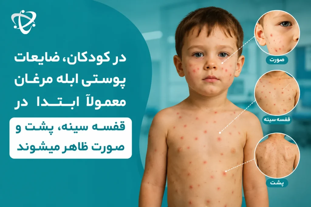 ضایعات پوستی ابله مرغان در کودکان