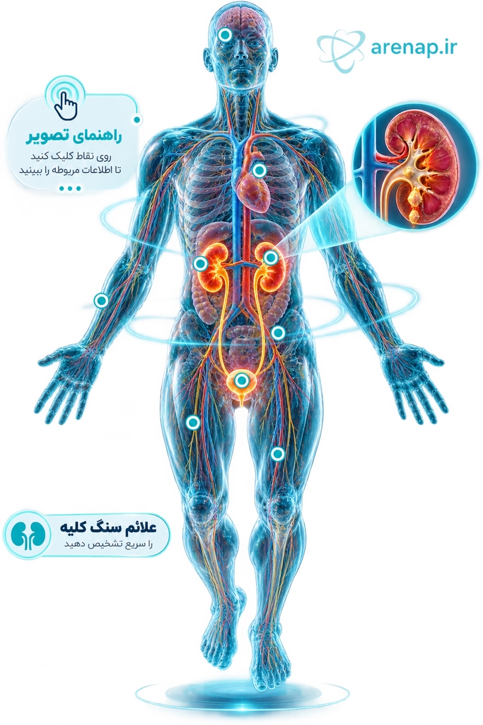 حرکت سنگ کلیه در حالب و ایجاد درد