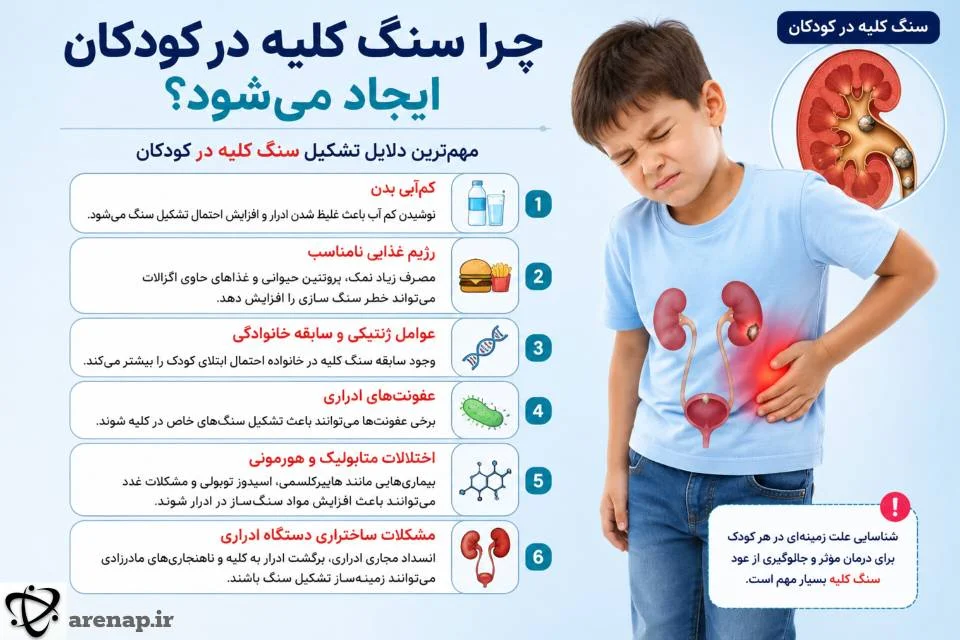 علل سنگ کلیه در کودکان_آرناپ
