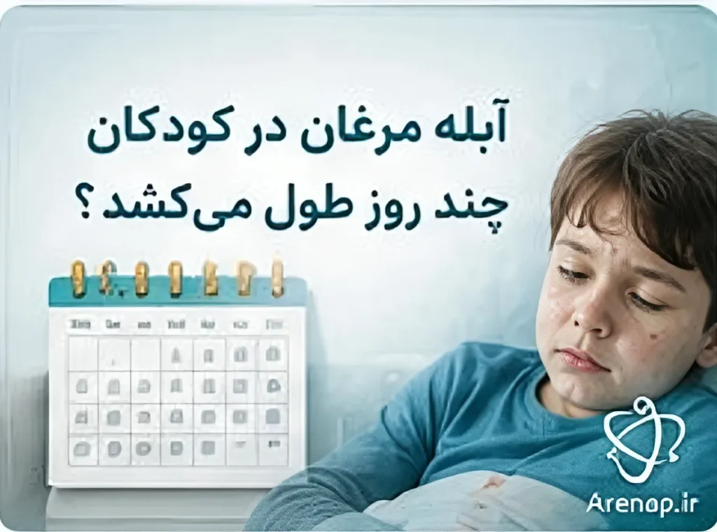 آبله مرغان در کودکان چند روز طول می‌کشد- ارناپ