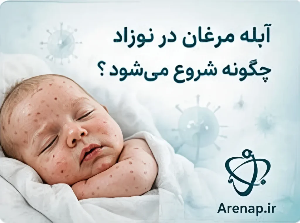 شروع ابله مرغان در نوزادان-ارناپ