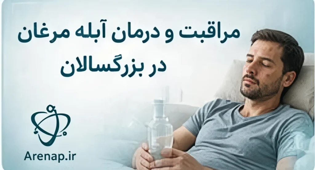 مراقبت و درمان آبله مرغان در بزرگسالان-ارناپ