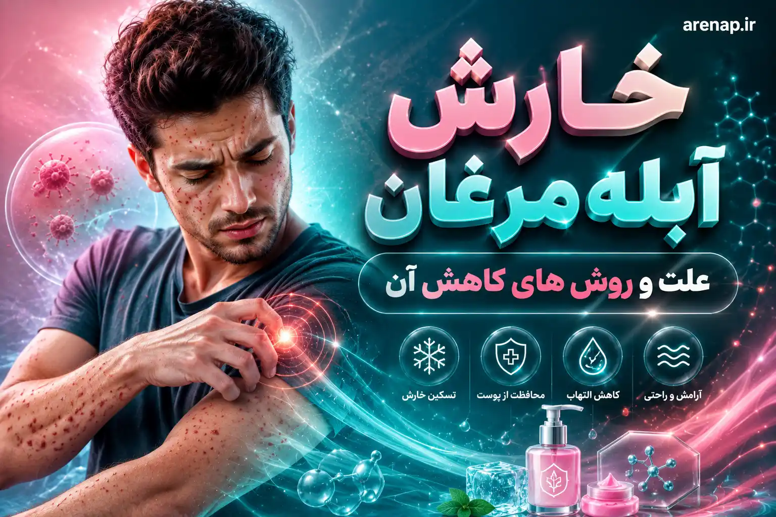 خارش آبله مرغان - آرناپ