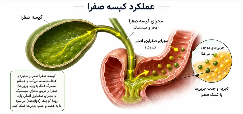 نمایش عملکرد طبیعی کیسه صفرا در هضم چربیها و مسیر خروج صفرا برای پیشگیری از تشکیل سنگ صفرا.