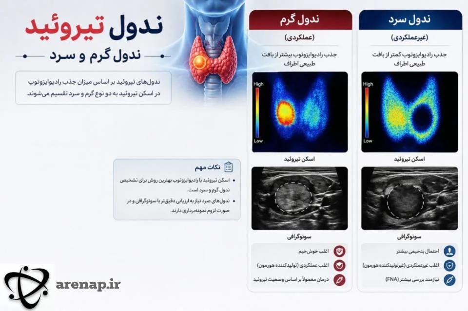 ندول تیروئید گرم و سرد در اسکن تیروئید_آرناپ