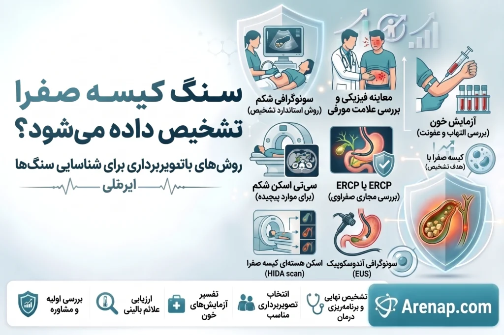 تشخیص سنگ کیسه صفرا