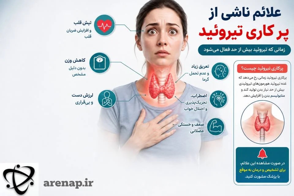 علائم پرکاری تیروئید در ندول تیروئید_آرناپ