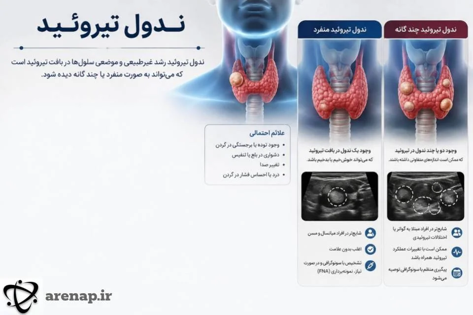 ندول تیروئید منفرد و چندگانه در غده تیروئید_آرناپ