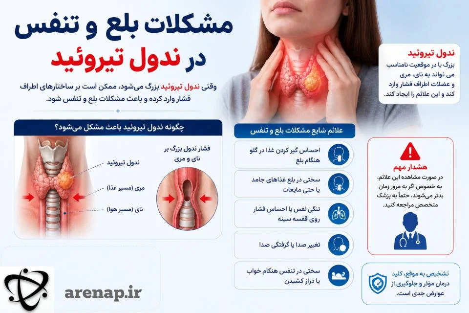 مشکلات بلع و تنفس در ندول تیروئید_آرناپ
