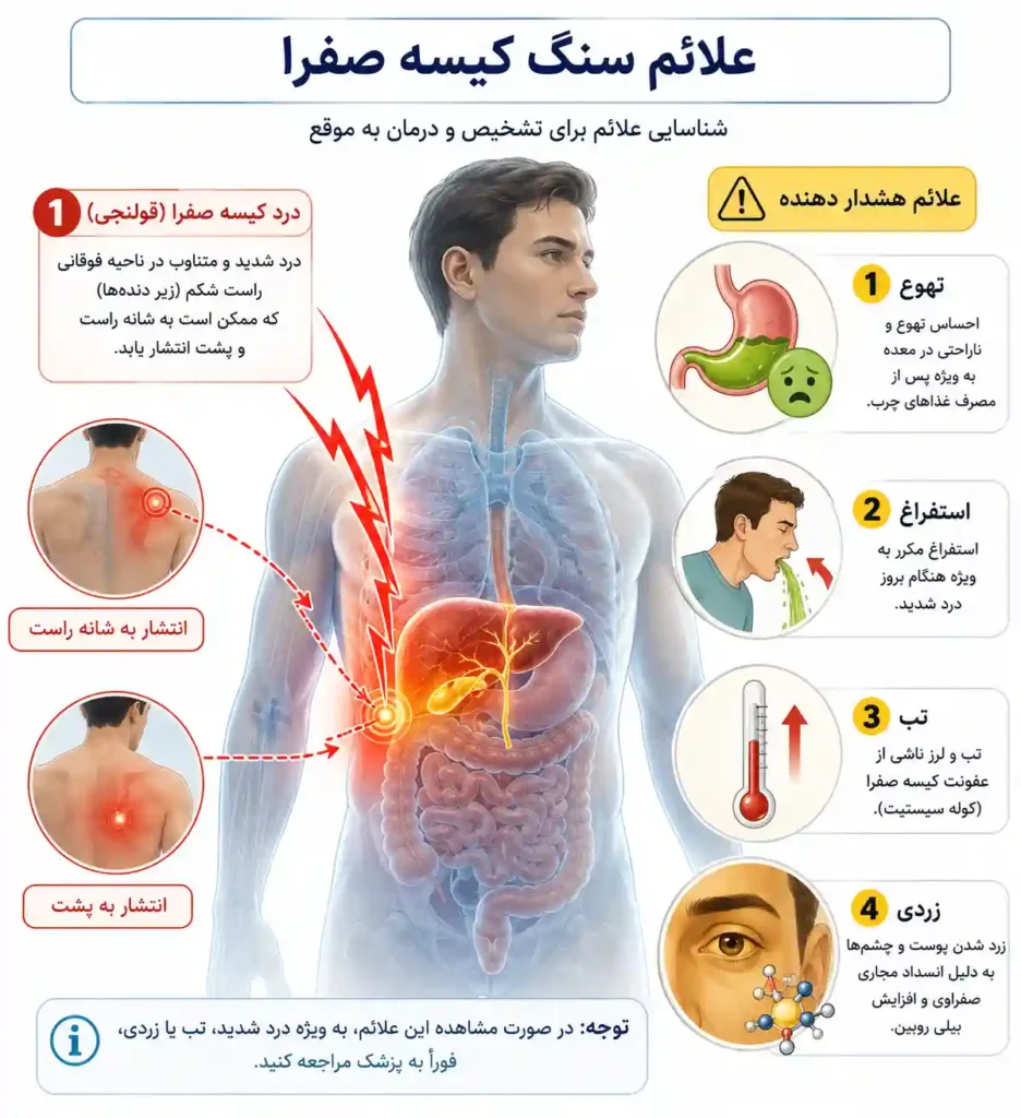 علائم سنگ کیسه صفرا شامل درد شدید شکم، انتشار درد به شانه و پشت، تهوع، استفراغ، تب و زردی پوست و چشمها