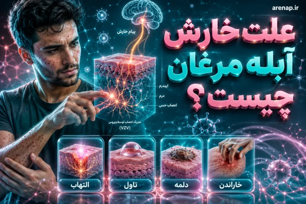دلیل تحریک پوست و ایجاد خارش هنگام آبله مرغان- آرناپ