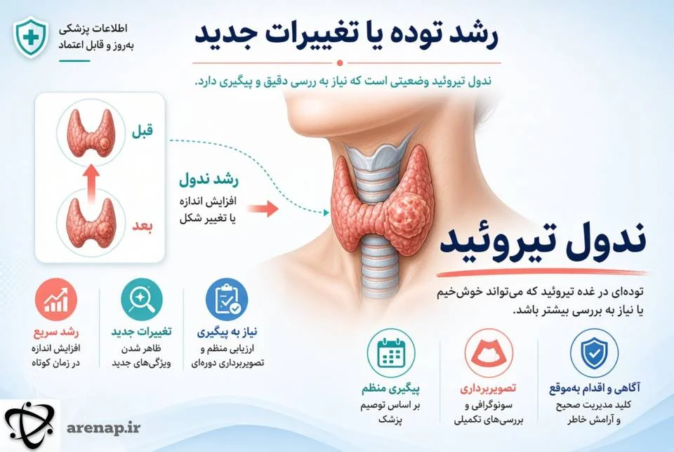 رشد ندول تیروئید و تغییرات جدید_آرناپ