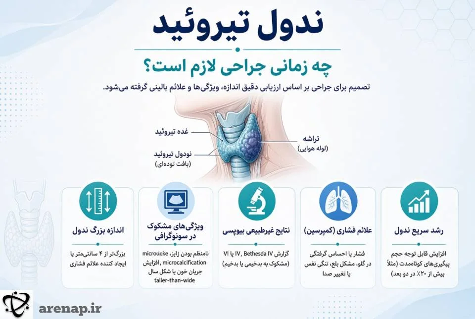 ندول تیروئید و زمان نیاز به جراحی_آرناپ