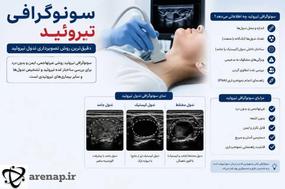 سونوگرافی تیروئید برای بررسی ندول‌ها و ویژگی‌های آن‌ها_آرناپ
