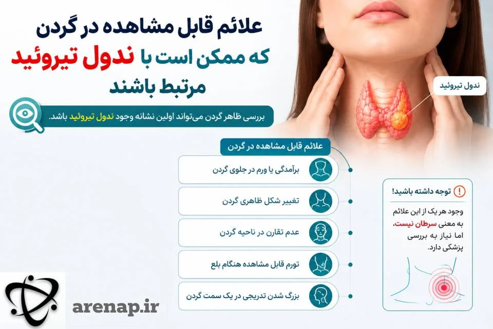 علائم قابل مشاهده ندول تیروئید در گردن_آرناپ