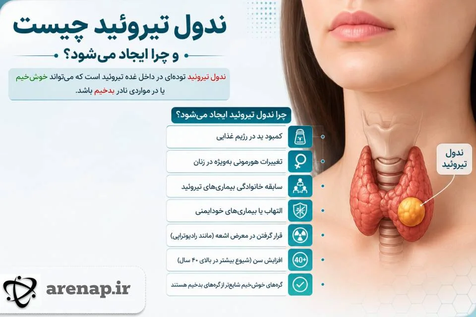 ندول تیروئید و علل ایجاد آن _ آرناپ
