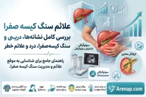 علائم سنگ کیسه صفرا چیست؟ بررسی کامل نشانه‌ها، درد و علائم خطر
