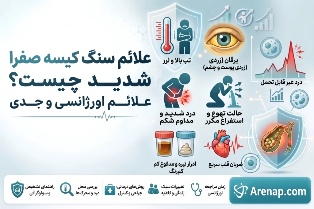علائم سنگ کیسه صفرا شدید
