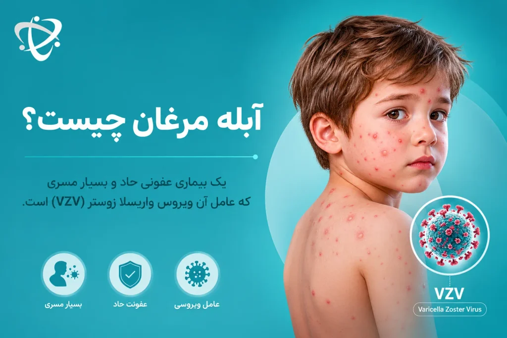آبله مرغان؛ بیماری عفونی مسری ناشی از ویروس واریسلا زوستر (VZV)