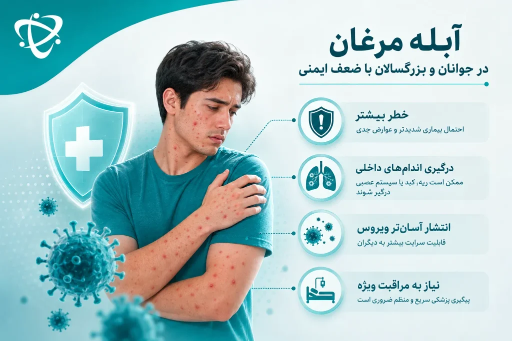 آبله مرغان در افراد با ضعف ایمنی؛ افزایش خطر بیماری شدید و درگیری اندام‌های داخلی
