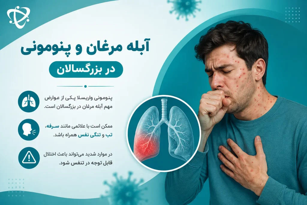 پنومونی واریسلا؛ درگیری ریه و اختلال تنفسی به‌عنوان عارضه آبله مرغان در بزرگسالان