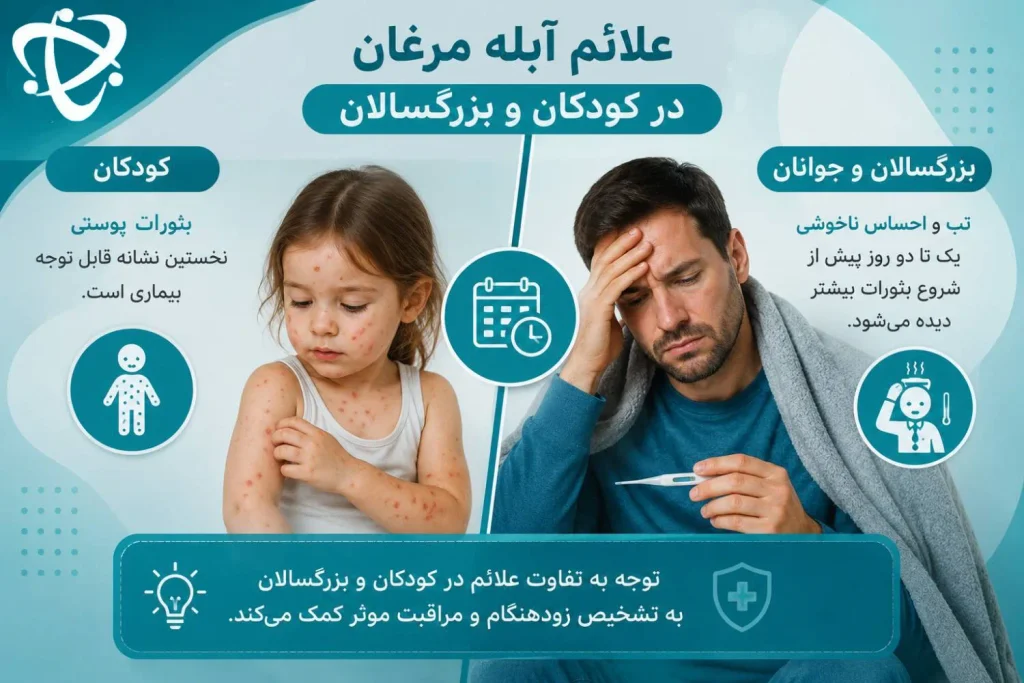 علائم آبله مرغان در کودکان و بزرگسالان؛ تفاوت زمان بروز تب و بثورات پوستی