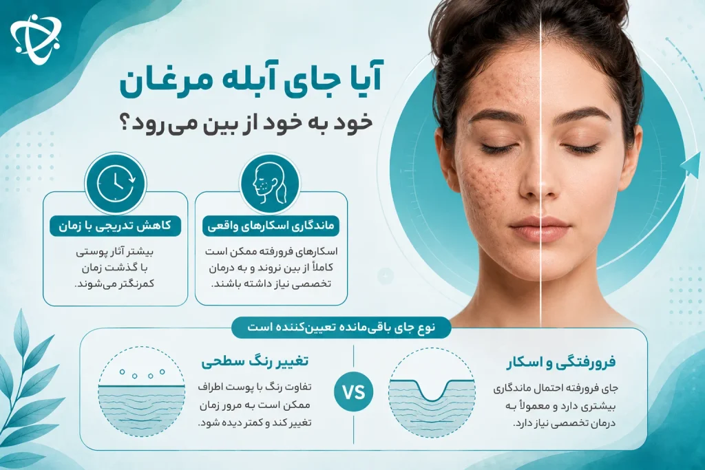 آیا جای آبله مرغان خود به خود از بین می‌رود یا باقی می‌ماند؟