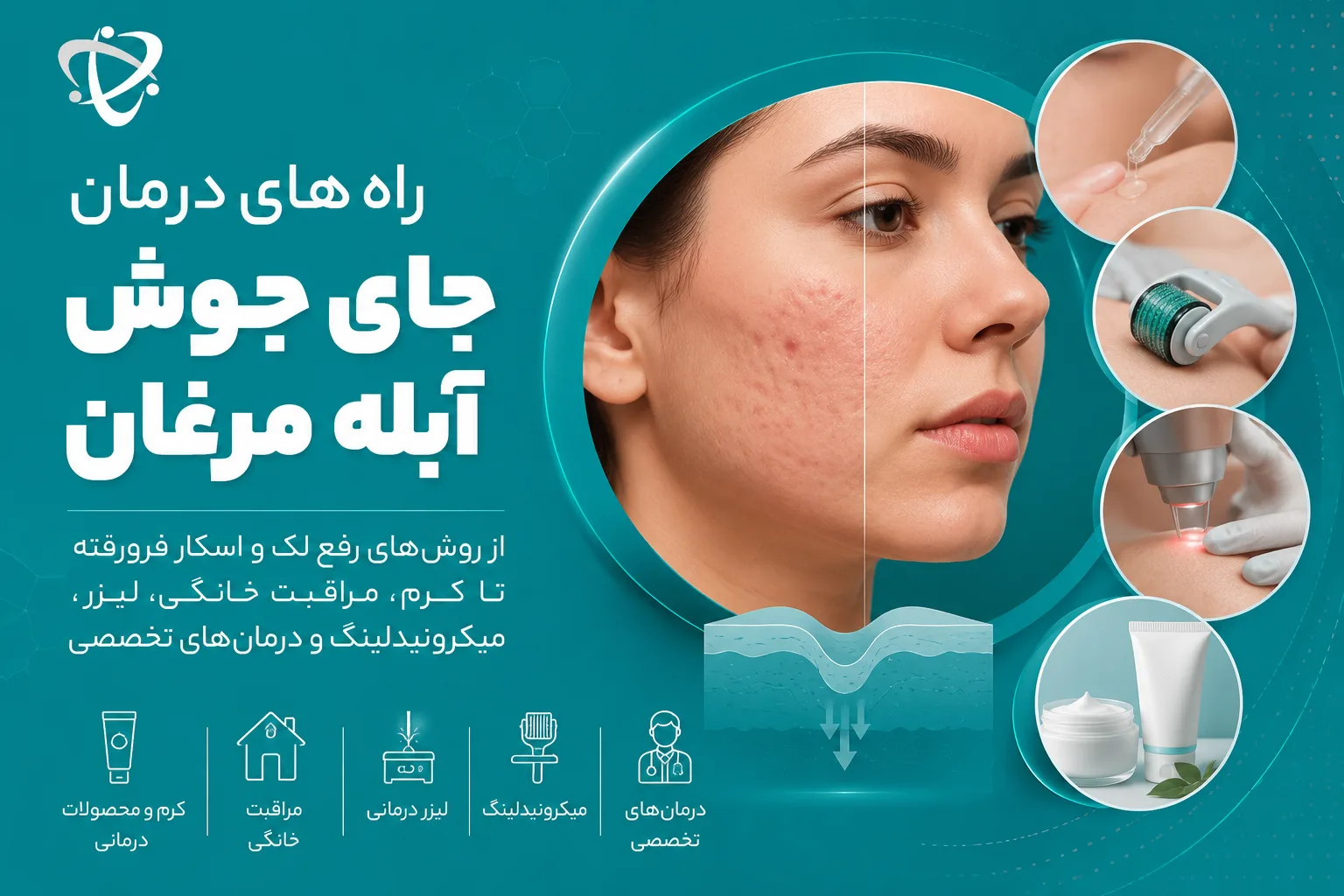 روش های موثر درمان جای جوش آبله مرغان - آرناپ