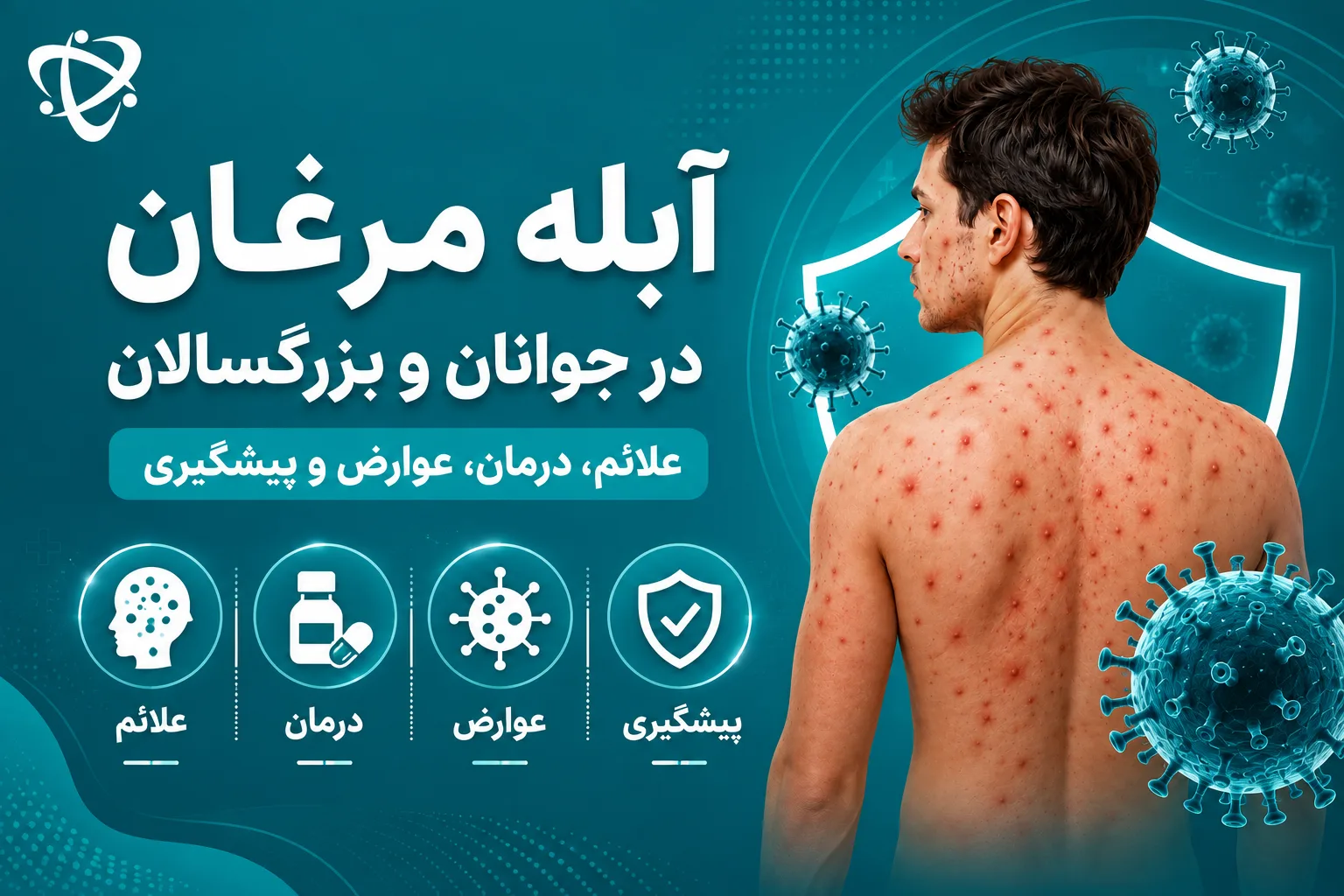 آبله مرغان در جوانان و بزرگسالان -آرناپ