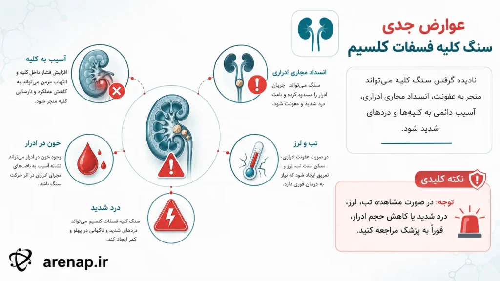 عوارض و علائم هشدار سنگ کلیه فسفات کلسیم - arenap
