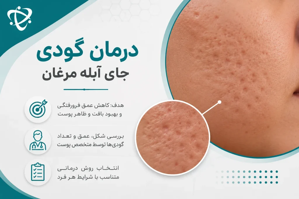 از بین بردن گودی جای آبله مرغان؛ کاهش فرورفتگی و بهبود بافت پوست