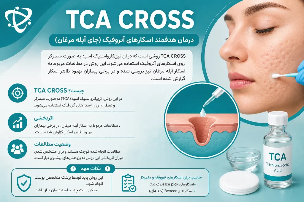 TCA CROSS برای از بین بردن گودی جای آبله مرغان قدیمی