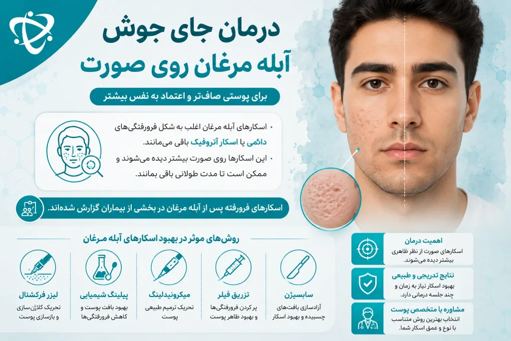 درمان جای آبله مرغان روی صورت؛ اسکارهای فرورفته و روش‌های بهبود آن