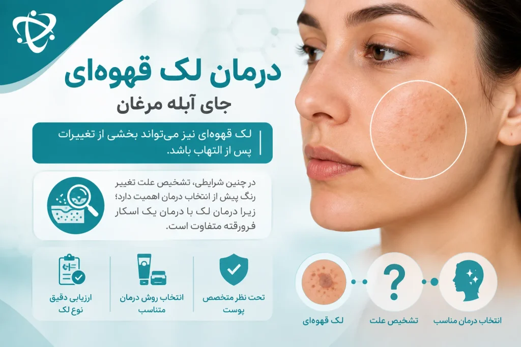 درمان لک قهوه‌ای جای آبله مرغان؛ تشخیص نوع لک پوستی