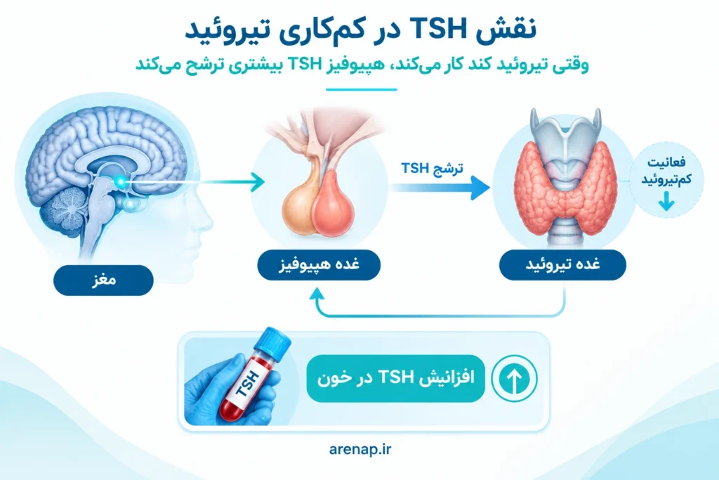 اینفوگرافیک نقش غده هیپوفیز و افزایش سطح TSH در خون هنگام کم‌کاری تیروئید - آرناپ