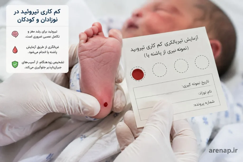 غربالگری تیروئید نوزادان و کم‌کاری تیروئید در نوزادان و کودکان