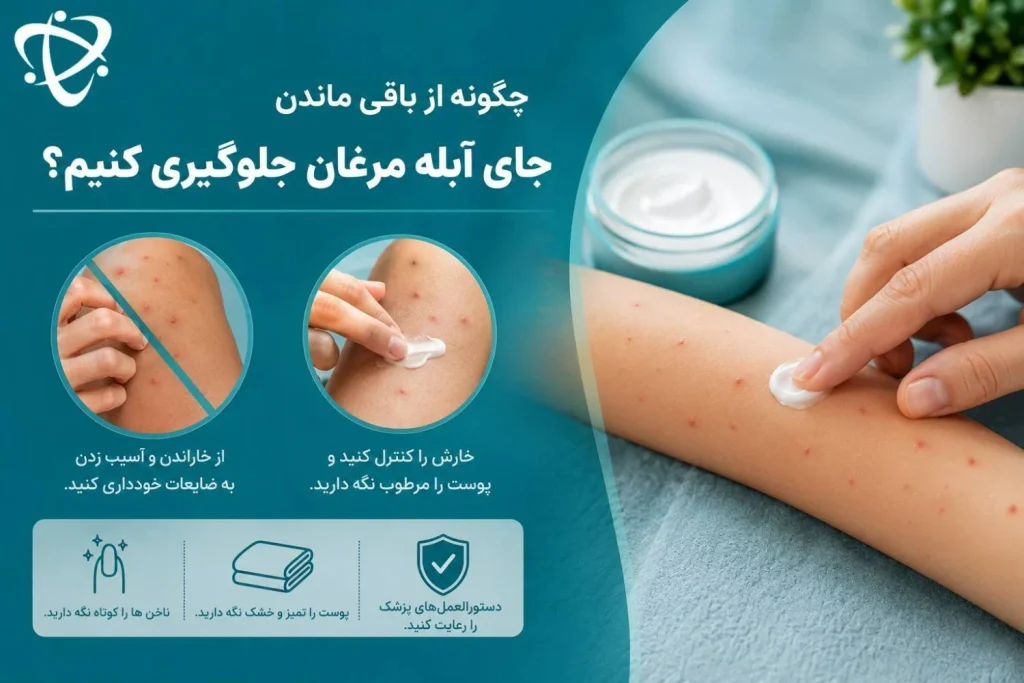 پیشگیری از جای آبله مرغان؛ کنترل خارش و جلوگیری از خراشیدن پوست