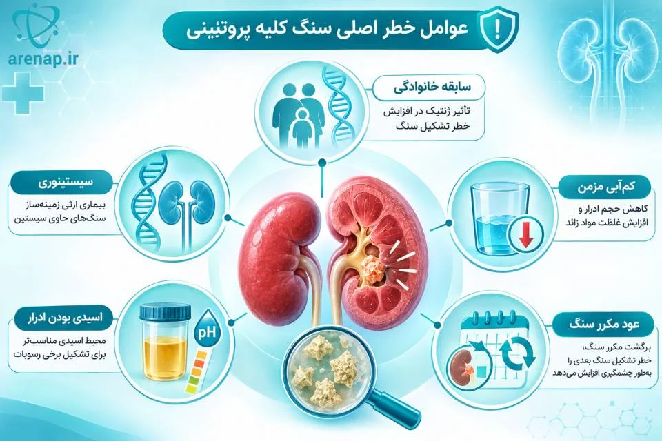 مهم‌ترین عوامل افزایش‌دهنده خطر تشکیل سنگ کلیه - ارناپ