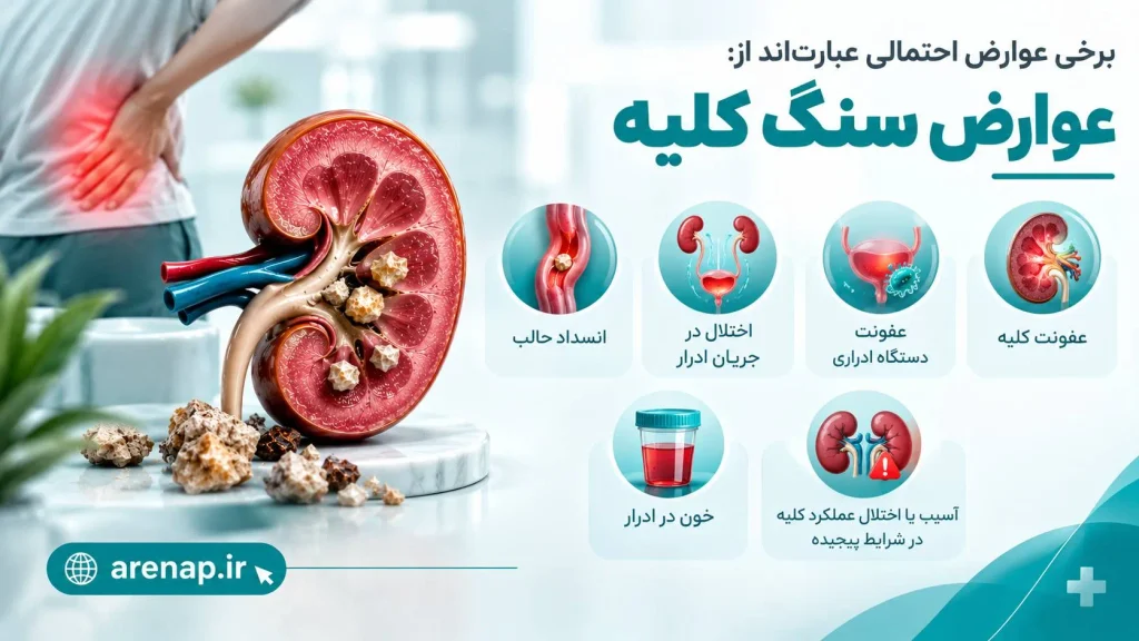 عوارض سنگ کلیه چیست؟-آرناپ