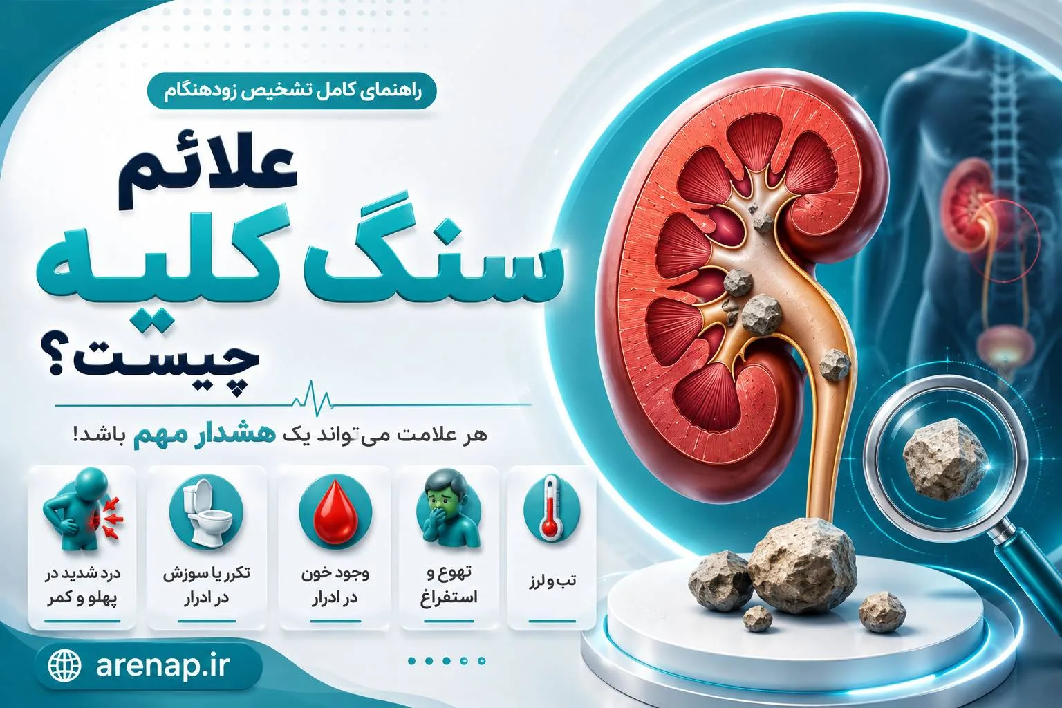 علائم سنگ کلیه چیست؟ - آرناپ