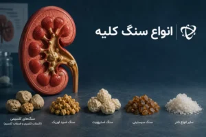 انواع سنگ کلیه - آرناپ