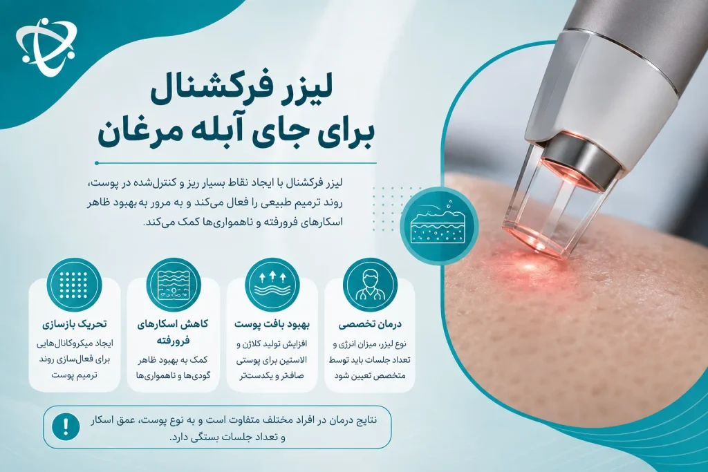 لیزر فرکشنال برای از بین بردن گودی جای آبله مرغان
