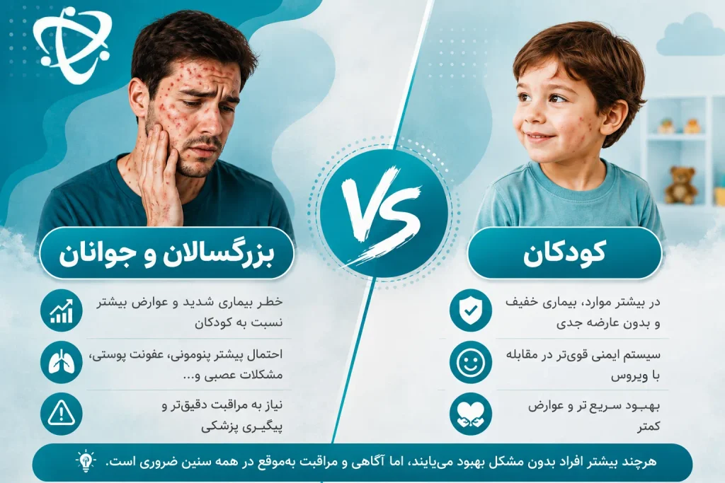 شدت آبله مرغان در بزرگسالان؛ افزایش احتمال بیماری شدید و عوارض نسبت به کودکان
