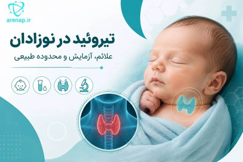 تیروئید در نوزادان - آرناپ
