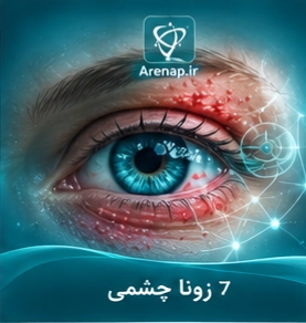 بیماری زونا چشمی-ارناپ