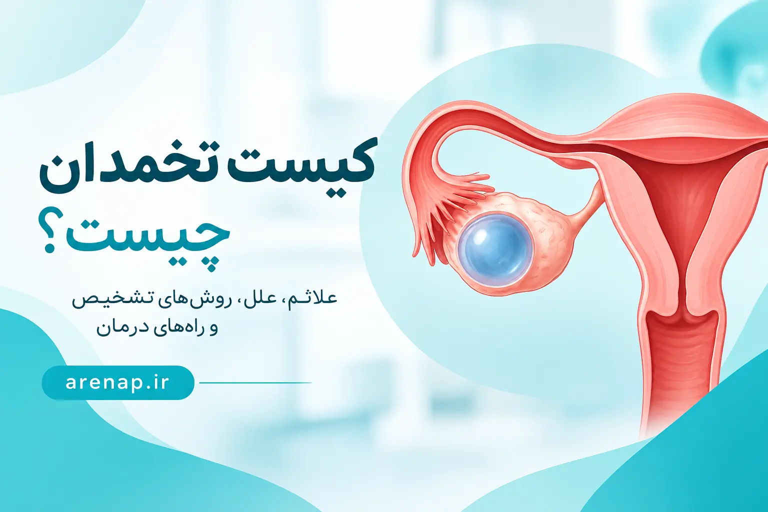 کیست تخمدان چیست؟ - آرناپ