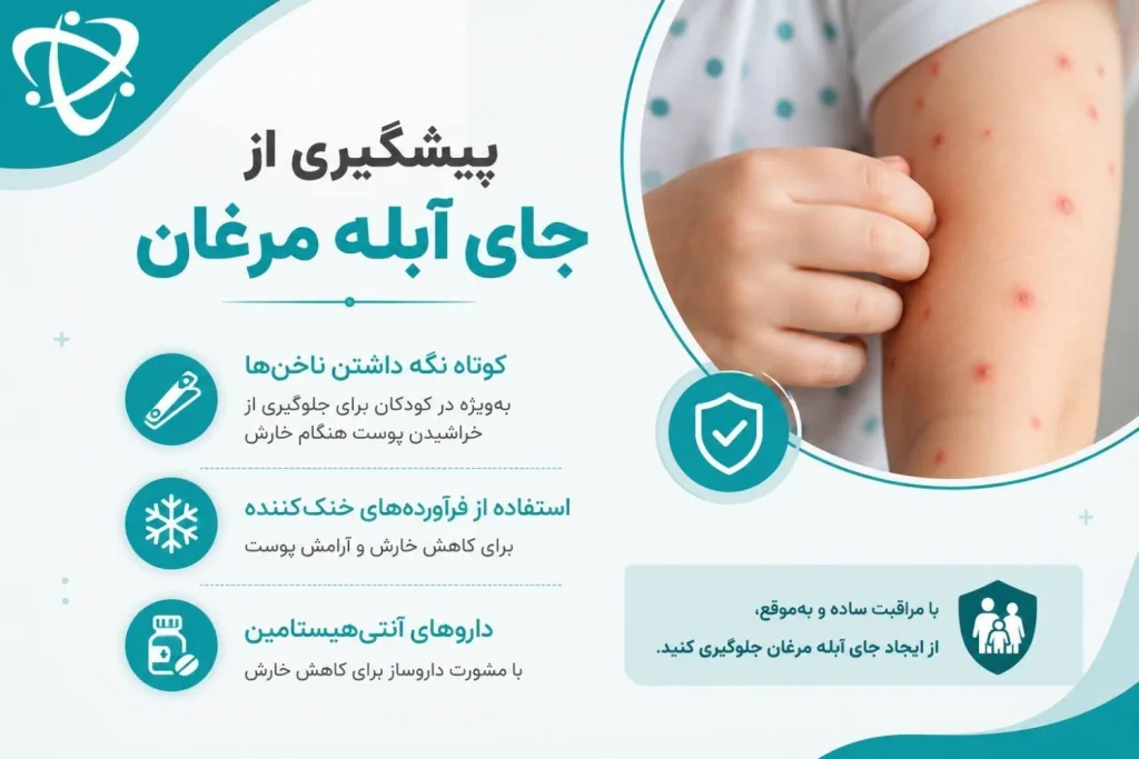 راهکارهای پیشگیری از جای آبله مرغان؛ کوتاه نگه داشتن ناخن‌ها